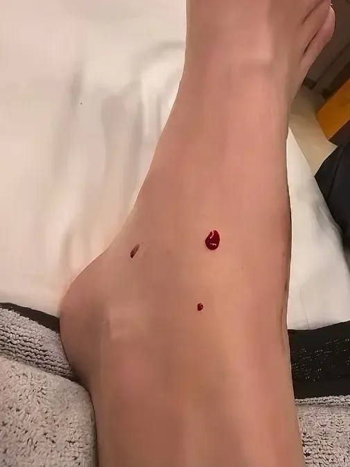 响的是她的, 而她的脚上